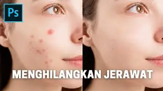 Tutorial Menghilangkan Jerawat di Photoshop