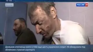Отряд ' ПРИВАЛЕННЫХ ' укропов на лечении в Донецке