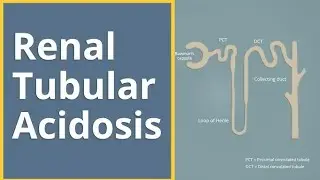 Renal Tubular Acidosis | Quick Revision | #Residency #fcps #renalsystem