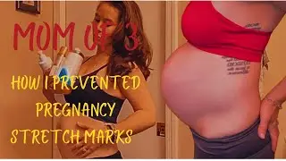 PREGNANCY AND STRETCH MARKS |WHAT AM I CURRENTLY DOING TO AVOID THEM|