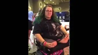 dak amputee transfering