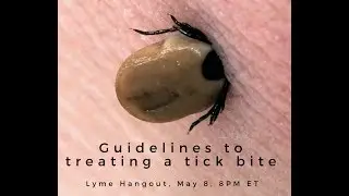 Guidelines to treating a tick bite
