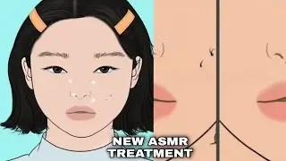 ASMR Soft Spoken Dehydrated Clogged Skin Facial | Oddly Satisfying Video | Asmr removal