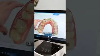 Szablony chirurgiczne co to takiego?