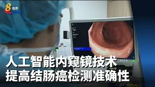 盛港综合医院引进人工智能内窥镜技术 提高结肠癌检测准确性