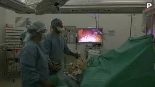 Obesity: sleeve gastrectomy, the operation that reduces the stomach