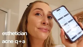 Acne specialist q + a (answering your questions!)