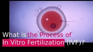 IVF PROCESS: HELPFUL STEP BY STEP GUIDE (In Vitro Fertilization)