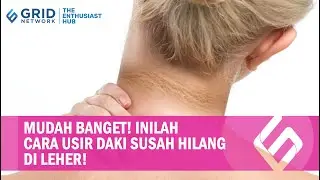 Daki Hitam Susah Hilang dari Leher, Coba Oleskan Bahan Alami Ini!