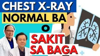 Chest X-ray. Normal Ba o Sakit sa Baga - Payo ni Doc Willie Ong