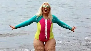 Everyone on the Internet laughed at her legs, but they fell silent when they learned her story