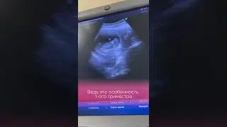 Апатия и усталость первого триместра