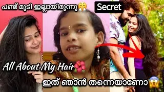 എല്ലാത്തിനും ഉള്ള ഉത്തരം💯All About My Hair🌼മടിയന്മാർക്ക് എളുപ്പ പണി🤩#haircare #tips #vlog #trending