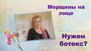 Морщины на лице, нужен ли ботекс...