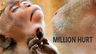 BILLION HURT... MILLION PITY SEEN SPRING STUCK ON NECK UNTIL LEAK NEARLY FOREIGN  BODY OUTSIDE |