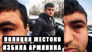 МУСОРА СЛОМАЛИ ЧЕЛЮСТЬ АРМЯНИНУ ! Беспредельщики из ГИБДД сфабриковали УГОЛОВНОЕ ДЕЛО по 318 УК РФ !
