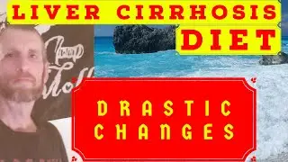 Liver Cirrhosis Diet and Exercise DRASTIC CHANGES ??