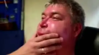 Когда оса укусила
