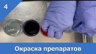 Интраоперационное цитологическое исследование опухолевого узла (приготовление микропрепарата)