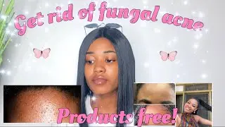 CLEAR YOUR SKIN WITHOUT PRODUCTS