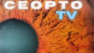 Fotografía ocular de segmento anterior, técnicas e instrumentos
