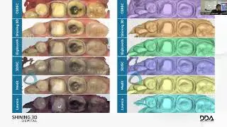 Интраоральный сканер Aoralscan 3 компании Shining 3D. ВВЕДЕНИЕ