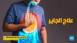 Dr Mohamed Ali Jouini  - brûlures d'estomac (علاج الجاير)