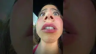 Fart issues 💨