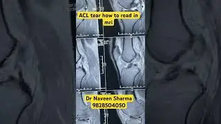 How to contact dr naveen sharma 9828504050 8290688810