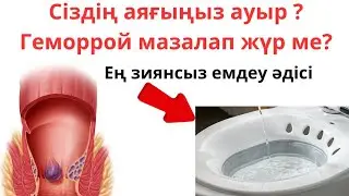ГЕМОРРОЙДЫ ЗИЯНСЫЗ ЕМДЕУ/ ЖҮКТІ КЕЗДЕ ГЕМОРРОЙДЫ ЕМДЕУ