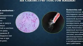 Выявление предраковых изменений слизистой оболочки толстой кишки с использованием технологии I-Scan