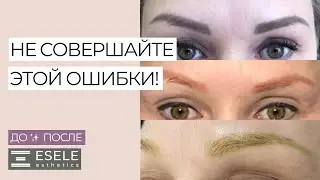 ЭТОТ ПЕРМАНЕНТ МОЖНО УДАЛИТЬ! КОМБИНИРОВАНАЯ МЕТОДИКА УДАЛЕНИЯ ПЕРМАНЕНТНОГО ТАТУАЖА БРОВЕЙ.