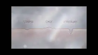 Реклама Контрактубекс Возьмите лечение шрамов в свои руки! 2013-2015 (1) (RU)