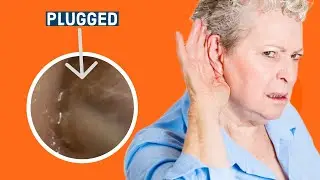 She couldn't hear ANYTHING - Tricky Ear Wax Removal Ep.002