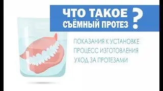 Съемный протез в стоматологии