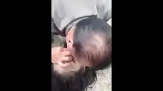 Girl Received CPR after strike by lightning