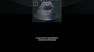 #узи #армдиассистент #дгпж