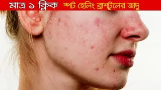 How to Use Spot Healing Brush Tool in Photoshop | Photoshop Tutorial