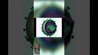 Поражение глаз при СПИДе. Запись видео-чата с офтальмологом Ермаковой Надеждой Алексеевной от 07.24.