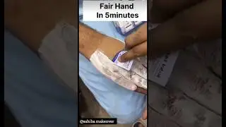 Get Fair Hand In 5 Mnts Instantly/Hand Whitening Hometipsll#feetwhitening #skincare #pedicure #viral
