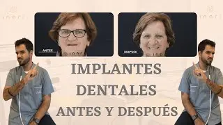 Implantes dentales Alcorcon