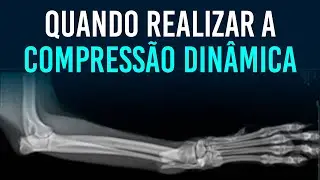 Quando realizar a compressão dinâmica da fratura?