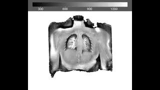 Pulmonary Lung Imaging Using 3D Dual-Echo Ultra-short Echo Time Modified Rosette k-space: PETALUTE