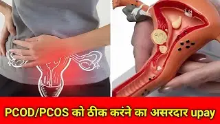 जल्द से जल्द PCOD/PCOS ठीक करने का सटीक उपाय #pcod #pcos @helpbyreetu