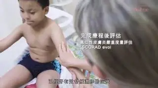 2016年真實治療濕疹個案 - 見証Avène活泉水的力量