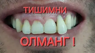 ПАРОДОНТОЗ КАНДАЙ КАСАЛЛИК ? МОСКВА . СТОМ   ШАВКАТ  +79636579707 ВАТСАП   ТЕЛЕГРАМ # stomatologiya