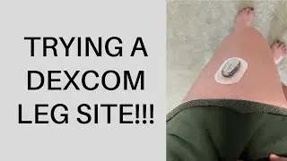 TRYING A DEXCOM LEG SITE | The Diabetic Cactus