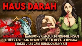 MENGERIKAN !! RAMBUTNYA MASUK PENGGILINGAN, TERCERABUT DAN MEMBESET KULIT WAJAH HINGGA KEPALANYA !!