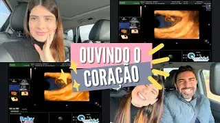 OUVINDO O CORAÇÃO DO BABY PELA PRIMEIRA VEZ - Thamyê Baseggio