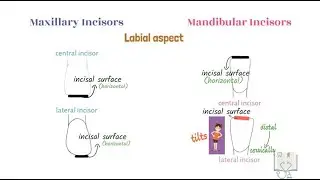 Differences between Maxillary Incisors & Mandibular Incisors